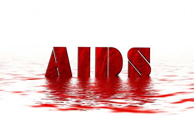 Simak Perbedaan, Gejala, Penyebab, Hingga Pencegahan HIV/AIDS