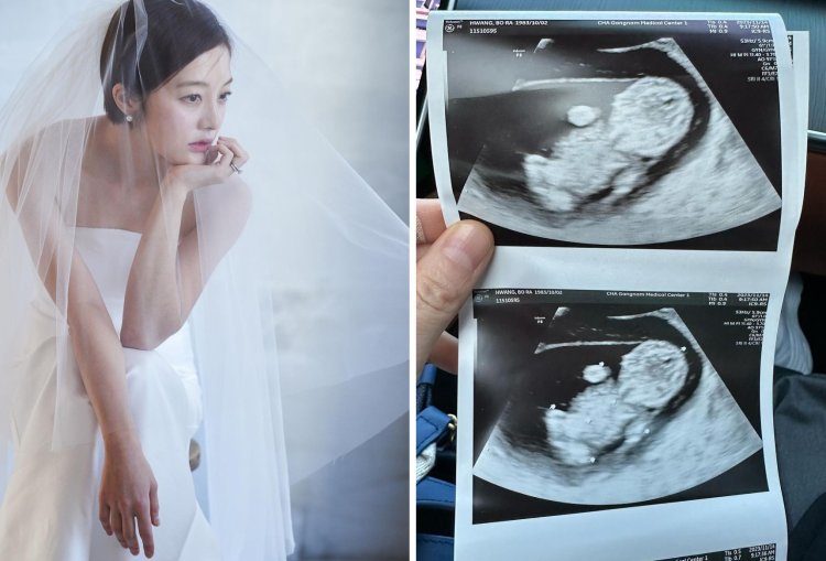 Kabar Bahagia! Hwang Bo Ra Hamil Anak Pertama Kim Young Hoon