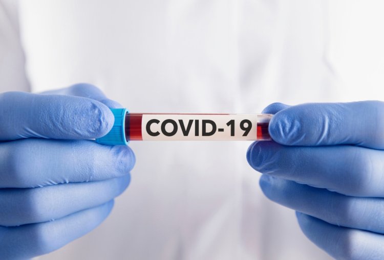 Covid-19 Naik Kembali, Dinkes DKI Imbau Warga Pakai Masker dan Vaksinasi Dosis Kelima