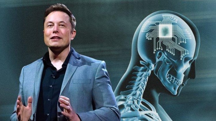 Elon Musk Akan Uji Coba Implan Chip Otak, Model Playboy Ini Siap Jadi Percobaan