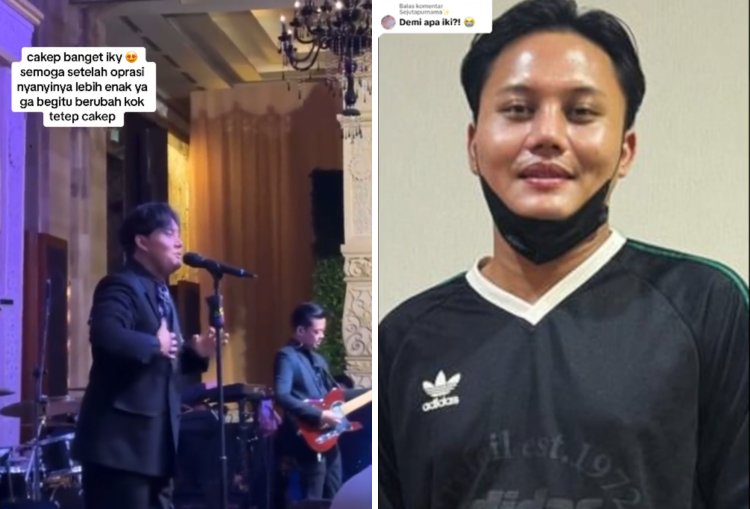 Sebelumnya Mahalini, Kini Rizky Febian Diduga Lakukan Oplas