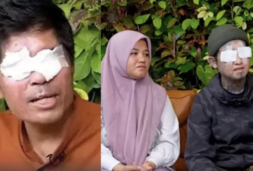 Beda dengan Agus Salim, Faisal Korban Mata Dicongkel di Acara Vespa Tak Sentuh Uang Donasi