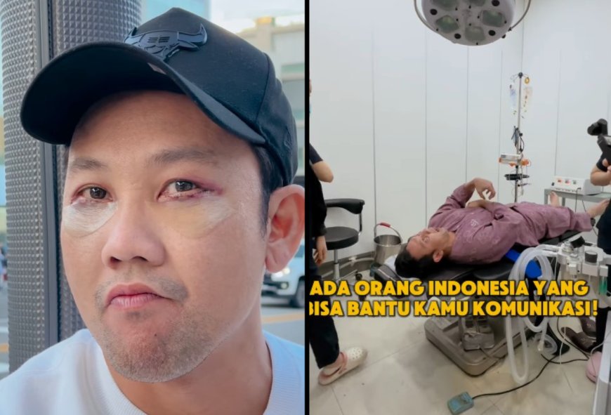 Denny Sumargo Jalani Operasi Plastik di Korea Selatan atas Permintaan Sang Istri