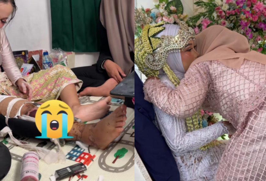 Viral, Pengantin Terluka Hadir di Hari Pernikahan Meski Mengalami Kecelakaan