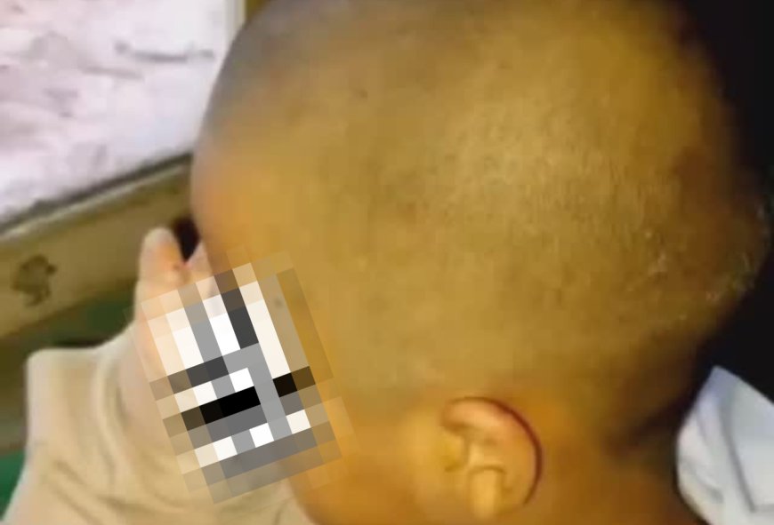 Tanpa Izin Orang Tua, Guru SD Cukur Rambut Siswi Karena Kutu