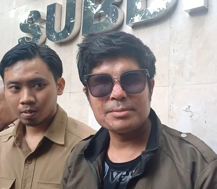 Terlalu Lama Tak Ditindak Operasi Karena Kasus Uang Donasi, Mata Agus Salim Kini Buta Total